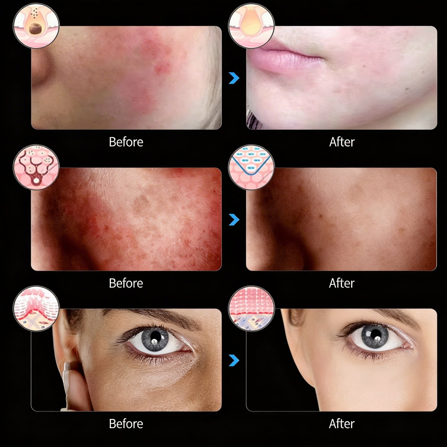 THERAWAVE™ LED THERAPY MASK